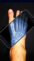 XRay Body Scanner Simulator