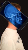 XRay Body Scanner Simulator