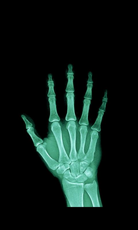Candy X-Ray :Prank