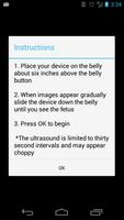 Prenatal Ultrasound Lite