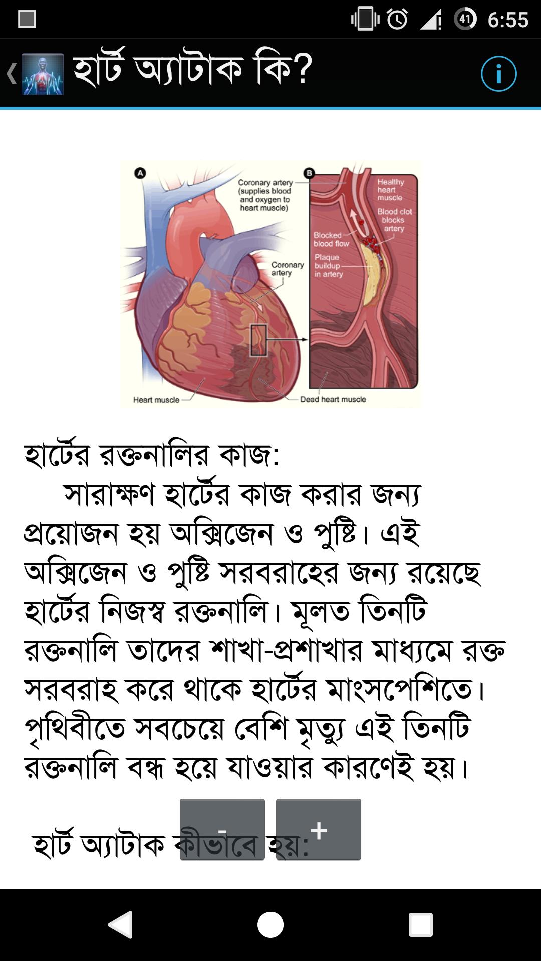 Heart Attack