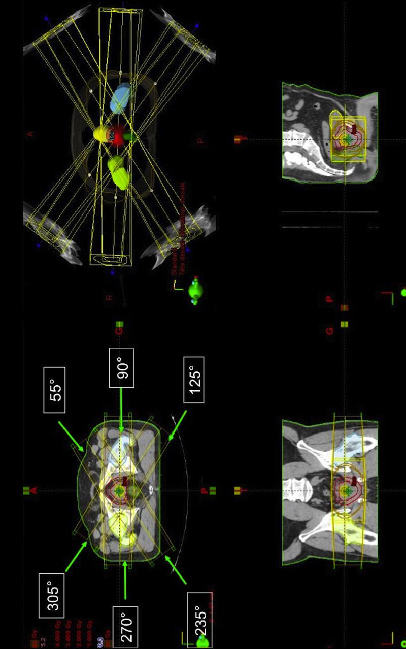 Siriade ORL, Neuro et Sarcome