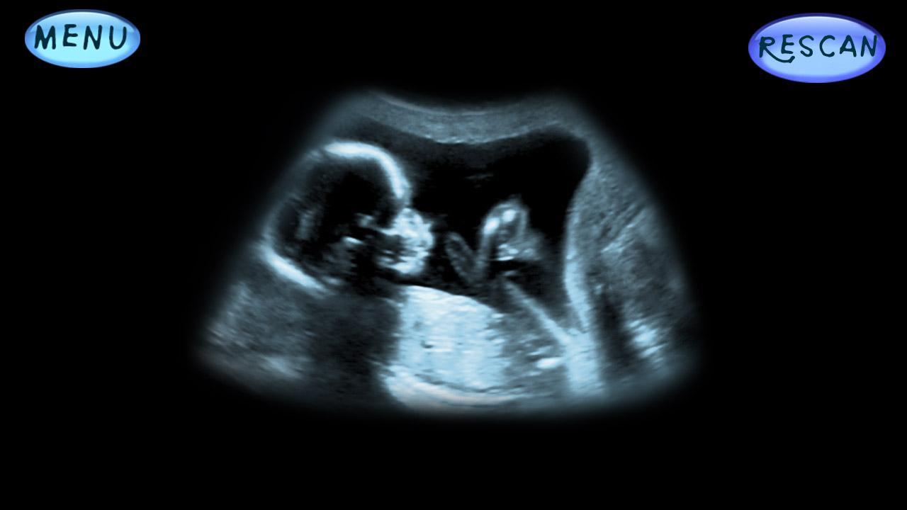 Simulator Ultrasound Joke